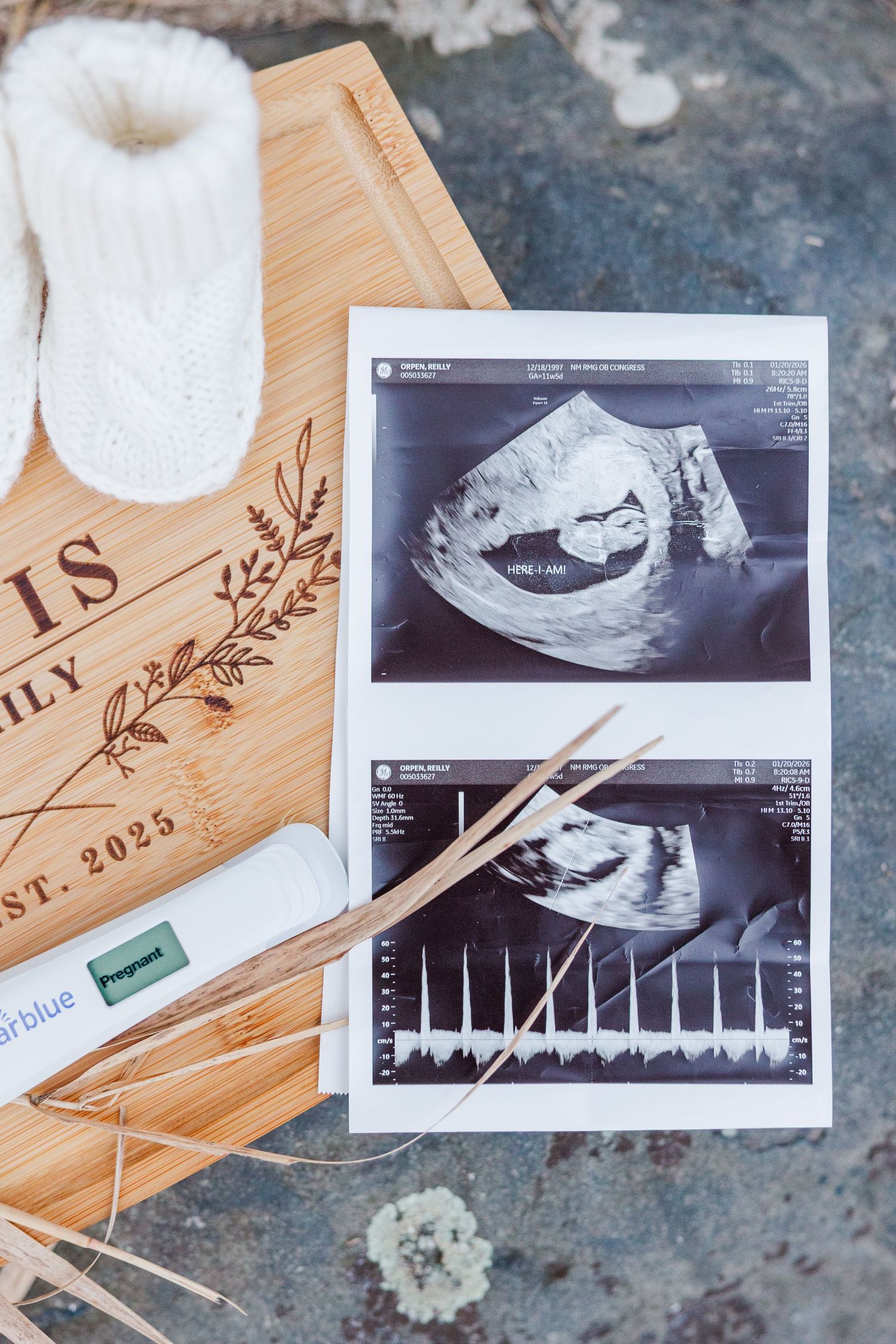 Ultrasound photos and pregnancy announcement details in Cary, Illinois