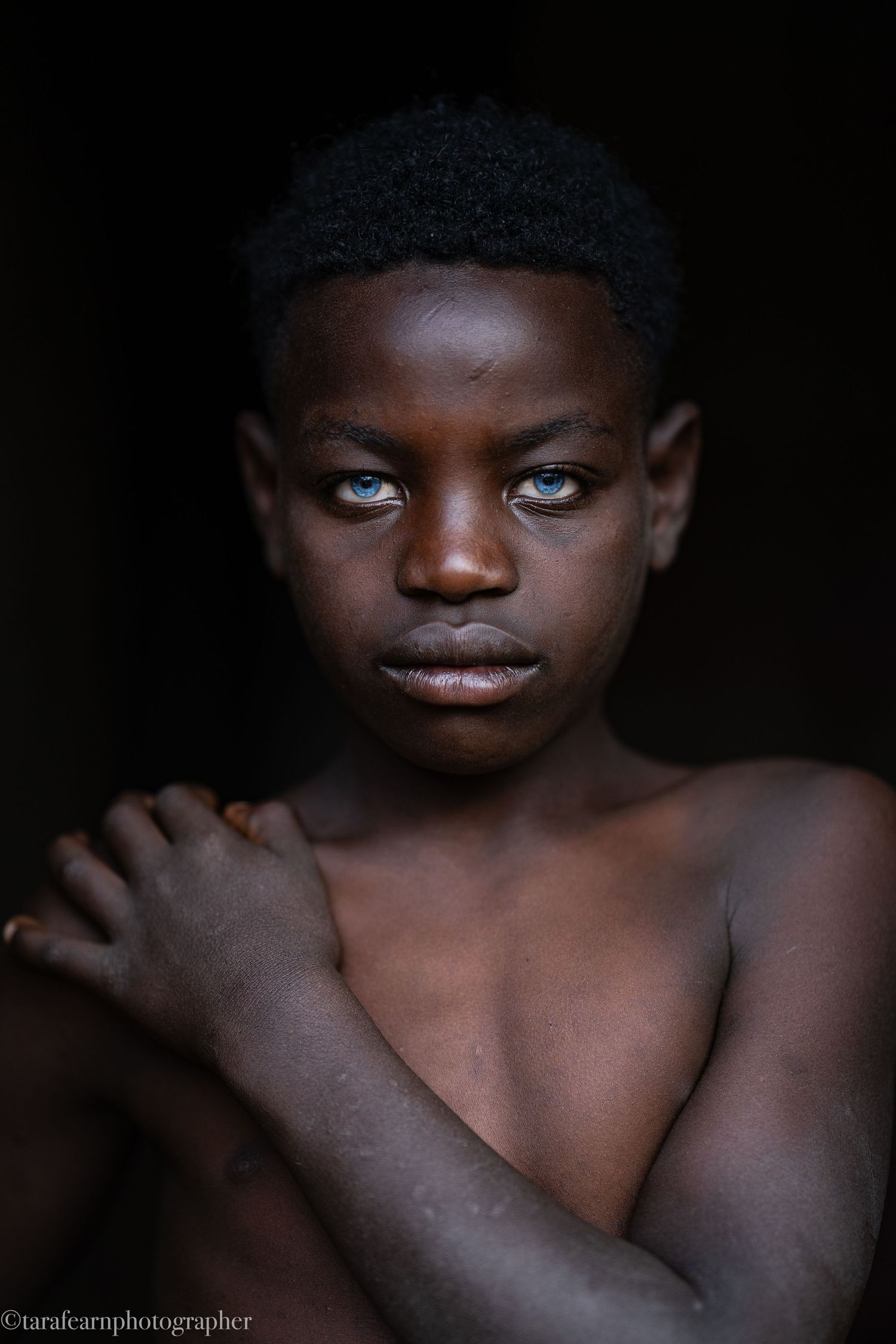 Close-up portrait of a young African boy with striking blue eyes against a dark background.