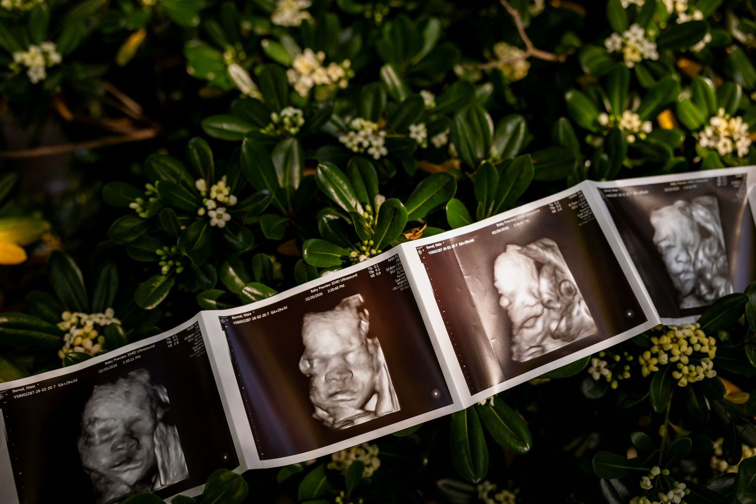 A strip of 3D ultrasound sonogram photos displayed among green leaves and small white flowers outdoors.