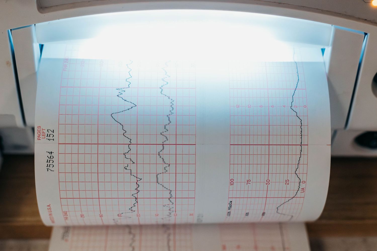 Heart-rate and contraction monitor