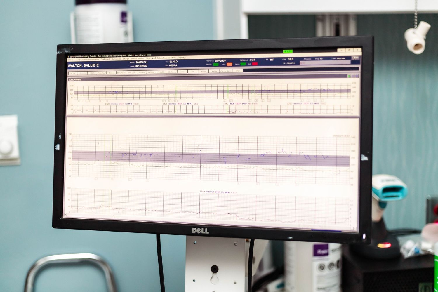 Computer monitor in hospital showing mother and baby's heart rates.