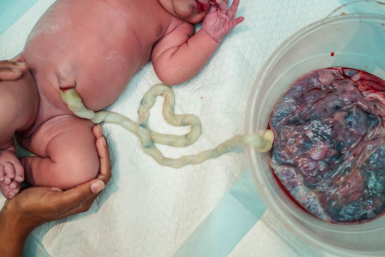 Baby still attached to cord and placenta