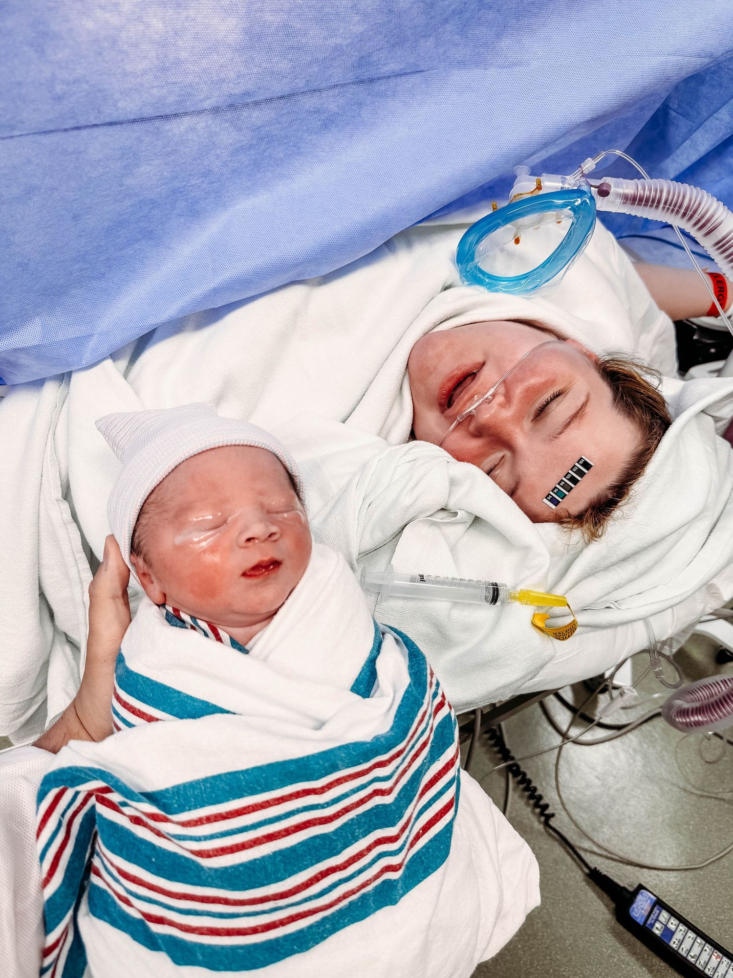 Mother meets baby after c-section