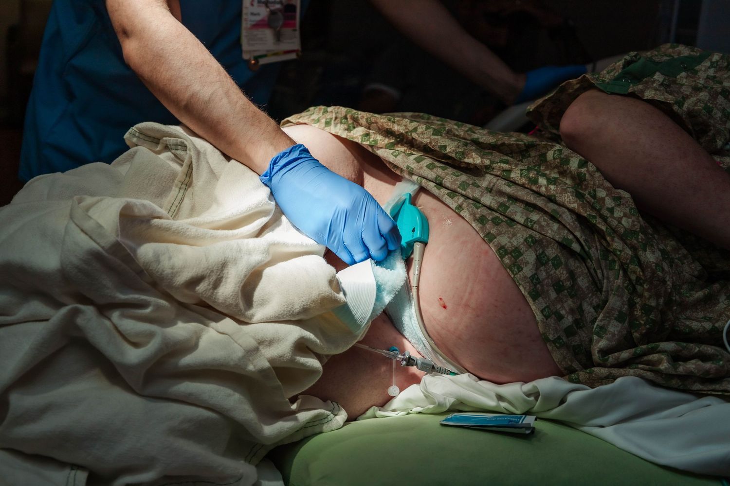 Nurse adjusts monitors on pregnant woman's belly