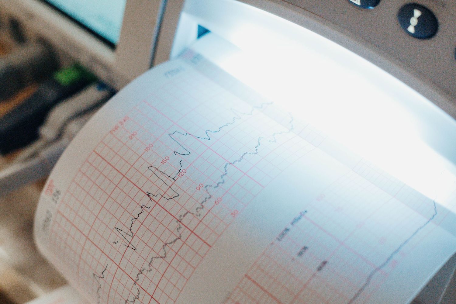 Baby's heart rate and mother's contractions paper from montior