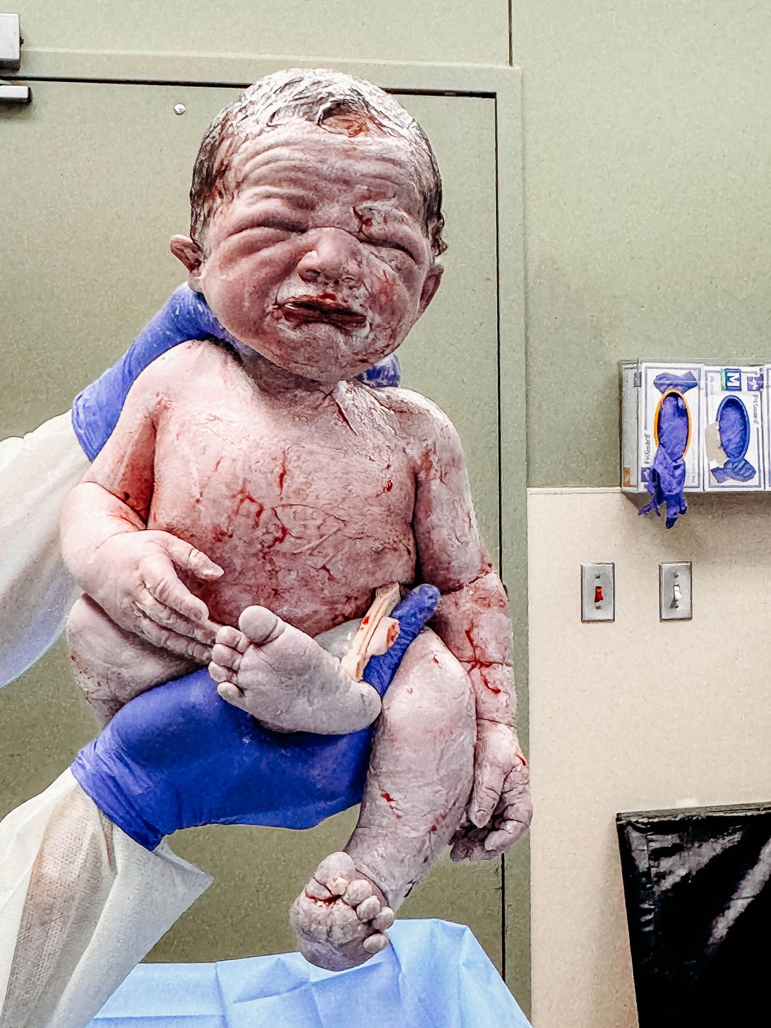 Baby held up by doctor covered in blood and vernix