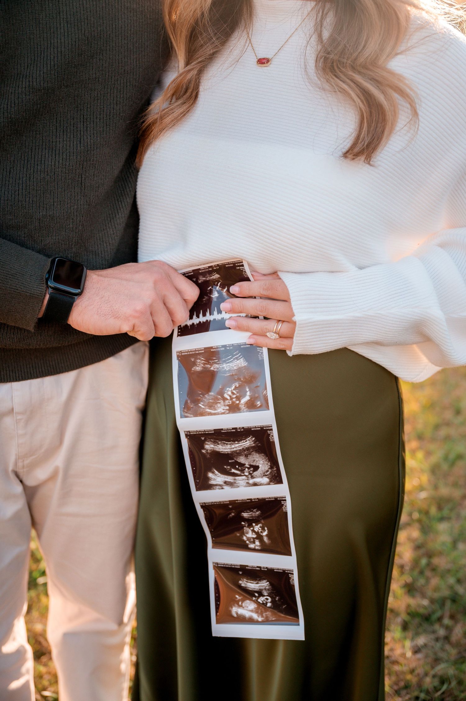 A sequence of ultrasound photos being held and displayed against an olive green background in natural lighting.