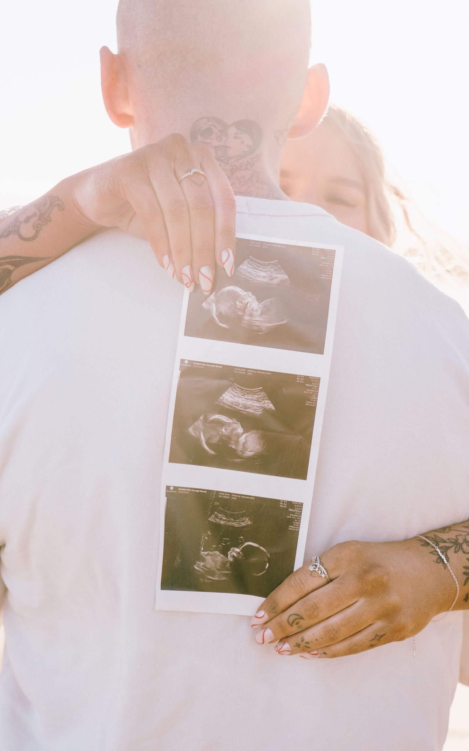 A series of ultrasound photos being held in hands against a bright sunlit background.
