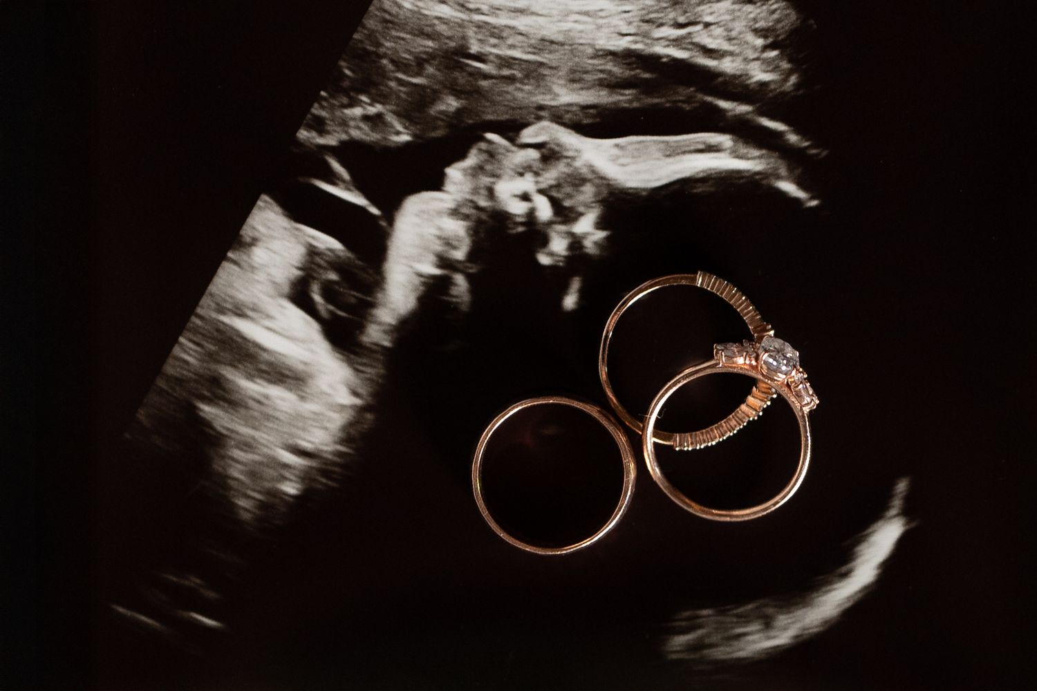 Two gold wedding rings and a diamond engagement ring resting on a black and white ultrasound image for a maternity session in Minneapolis.