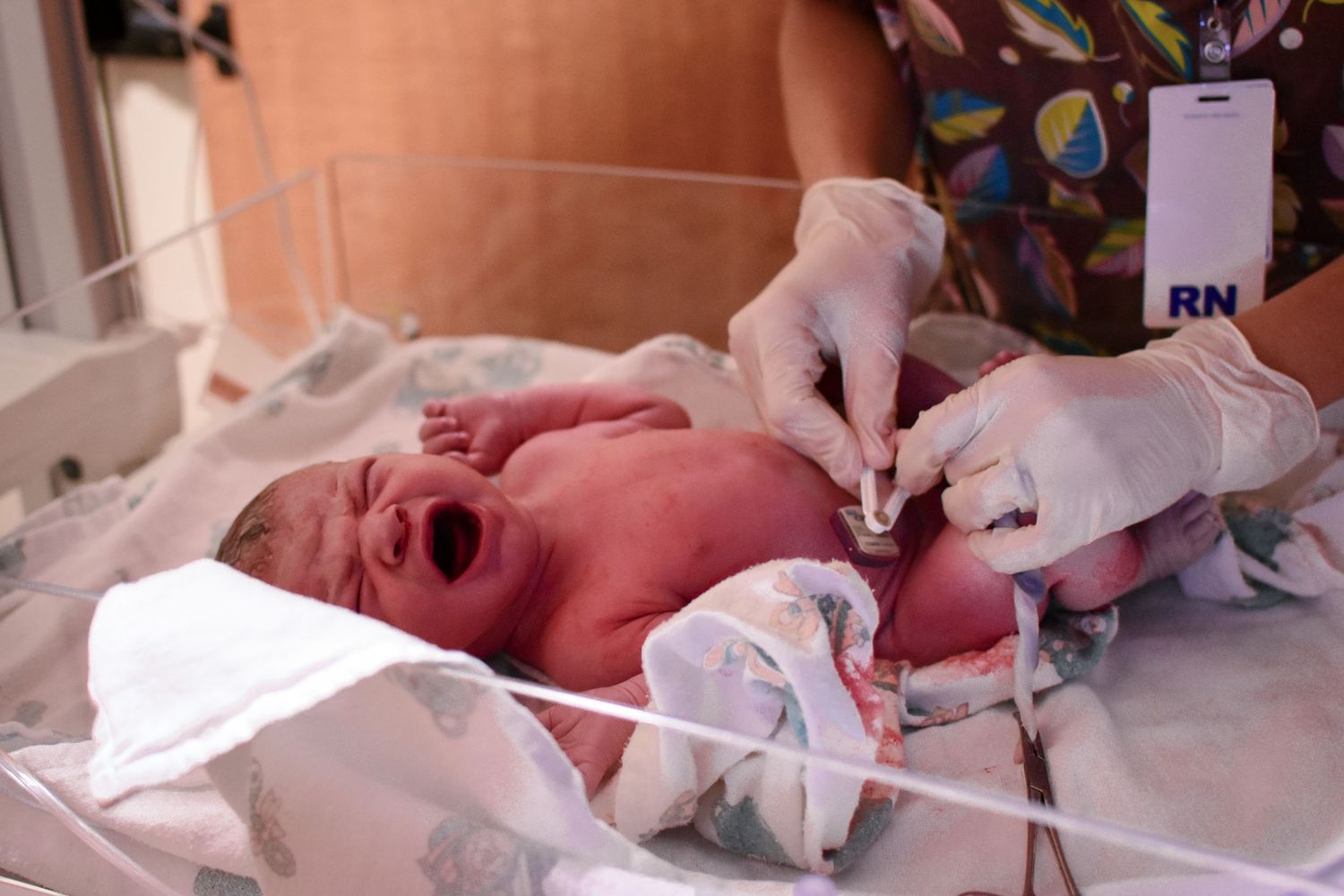 Nurse in gloves clamping the umbilical cord of a crying newborn baby in hospital warmer.