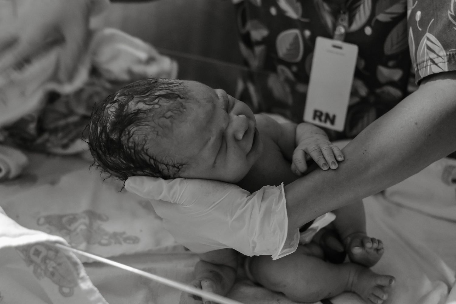 A black and white photo of a newborn baby being examined by a gloved nurse after delivery.