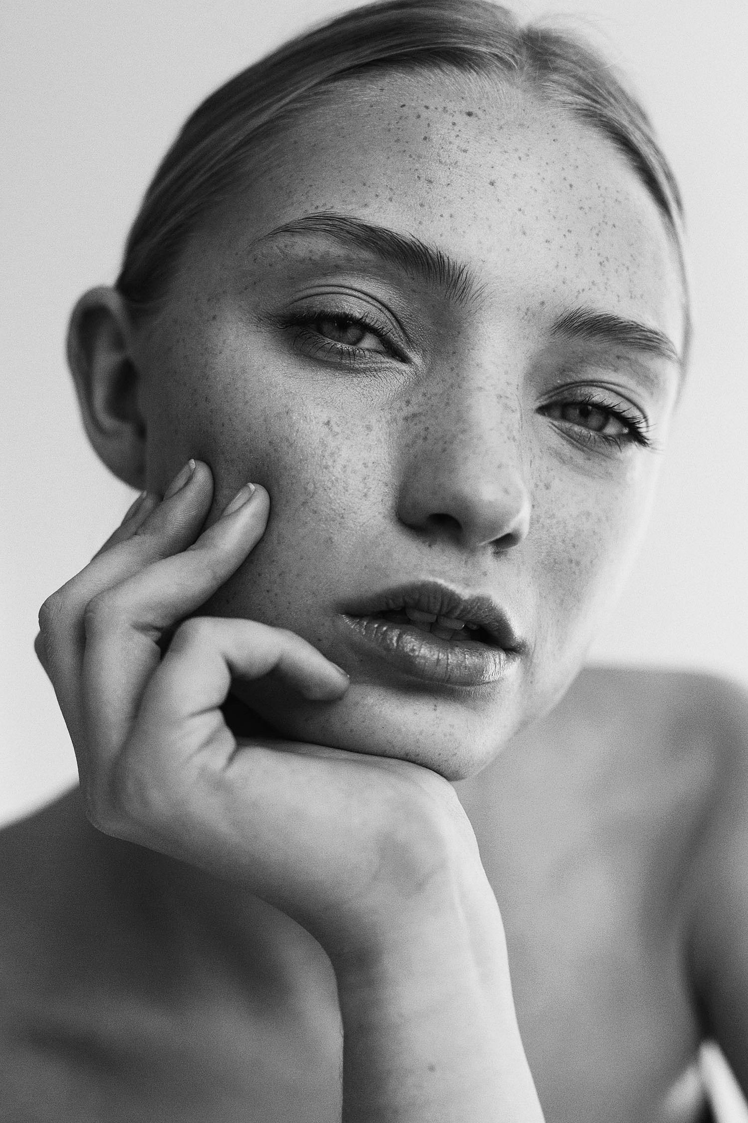 Black and white portrait of a freckled woman resting her chin on her hand with a soft, contemplative gaze.