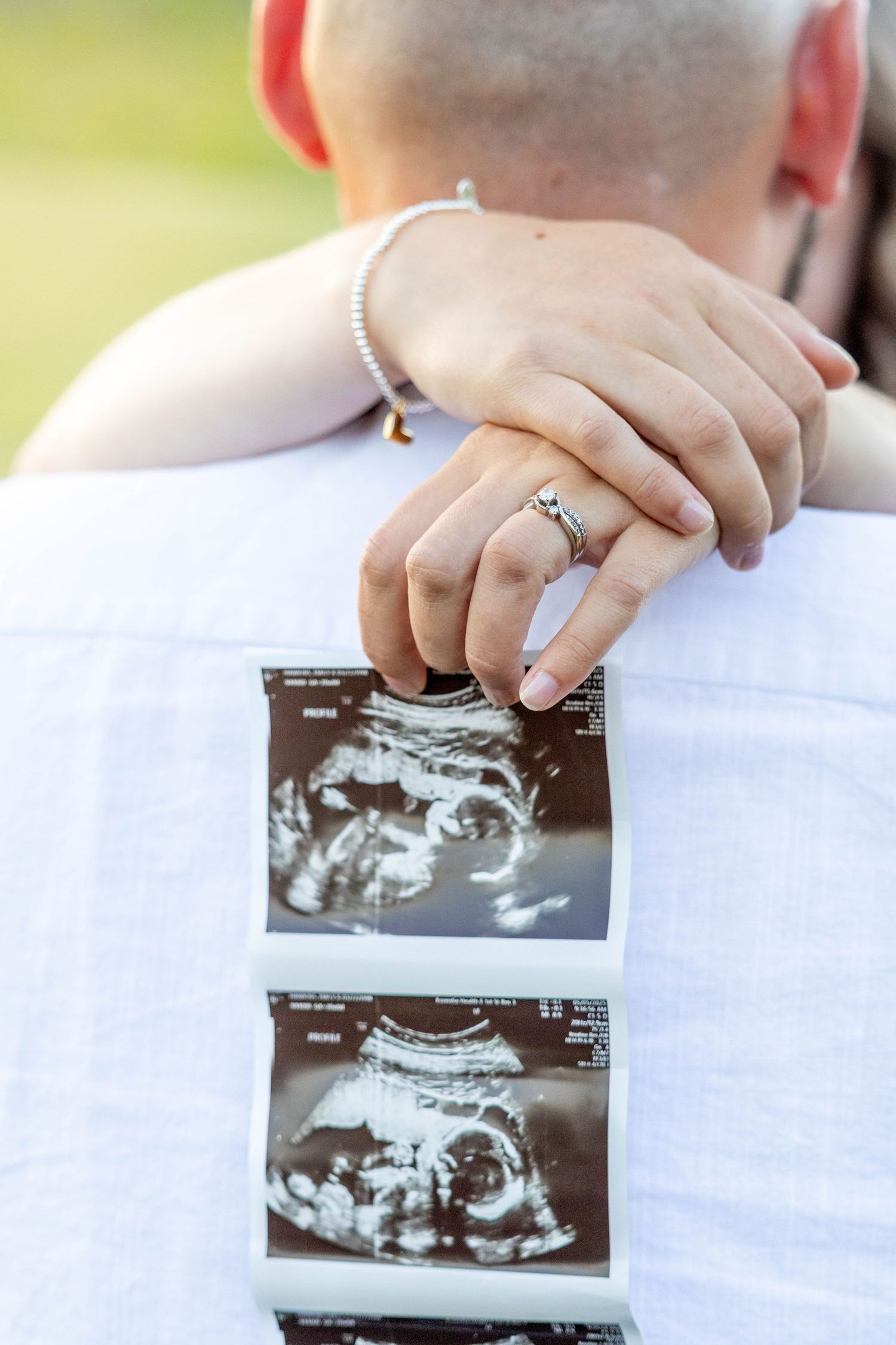 Hand wearing an engagement ring holding ultrasound photos showing a pregnancy scan on a white surface.