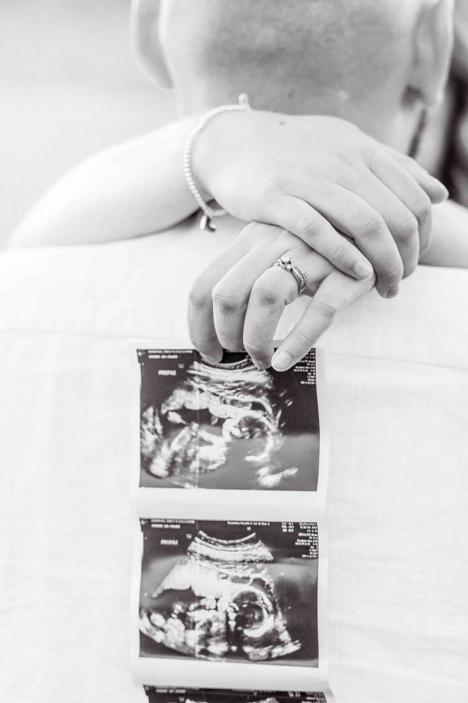 Hands hold black and white ultrasound photos showing a developing baby in the womb.