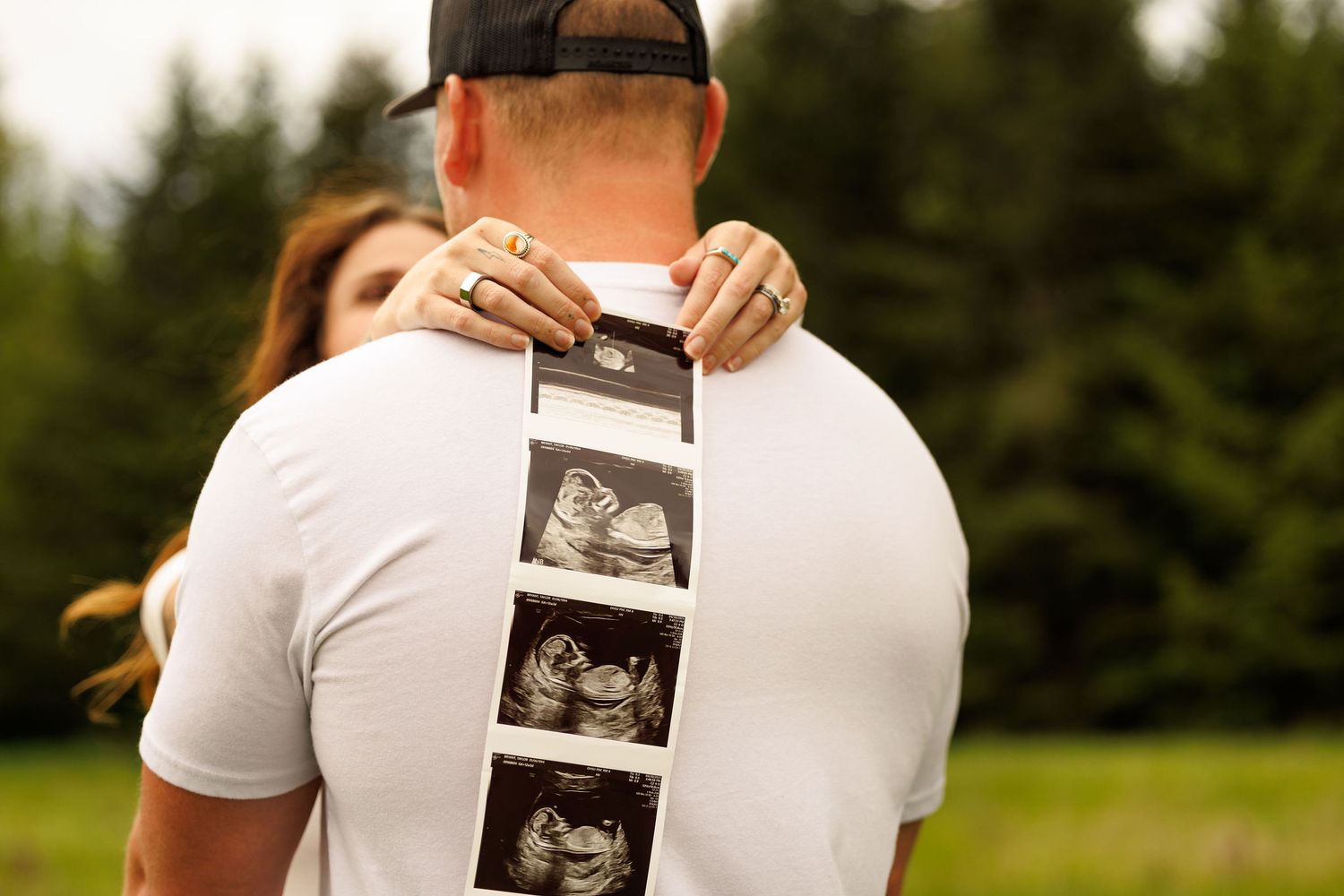Someone standing outdoors holds up series of ultrasound photos to capture sequential pregnancy pregnancy announcement moments.