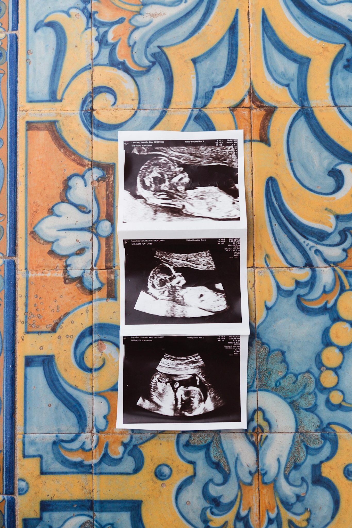 Three ultrasound baby photos displayed on colorful blue and yellow mosaic tiles.