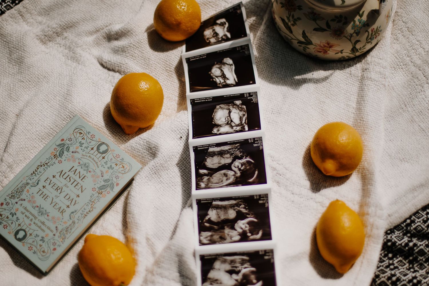 Ultrasound photos strip surrounded by yellow lemons on white cloth with vintage book.