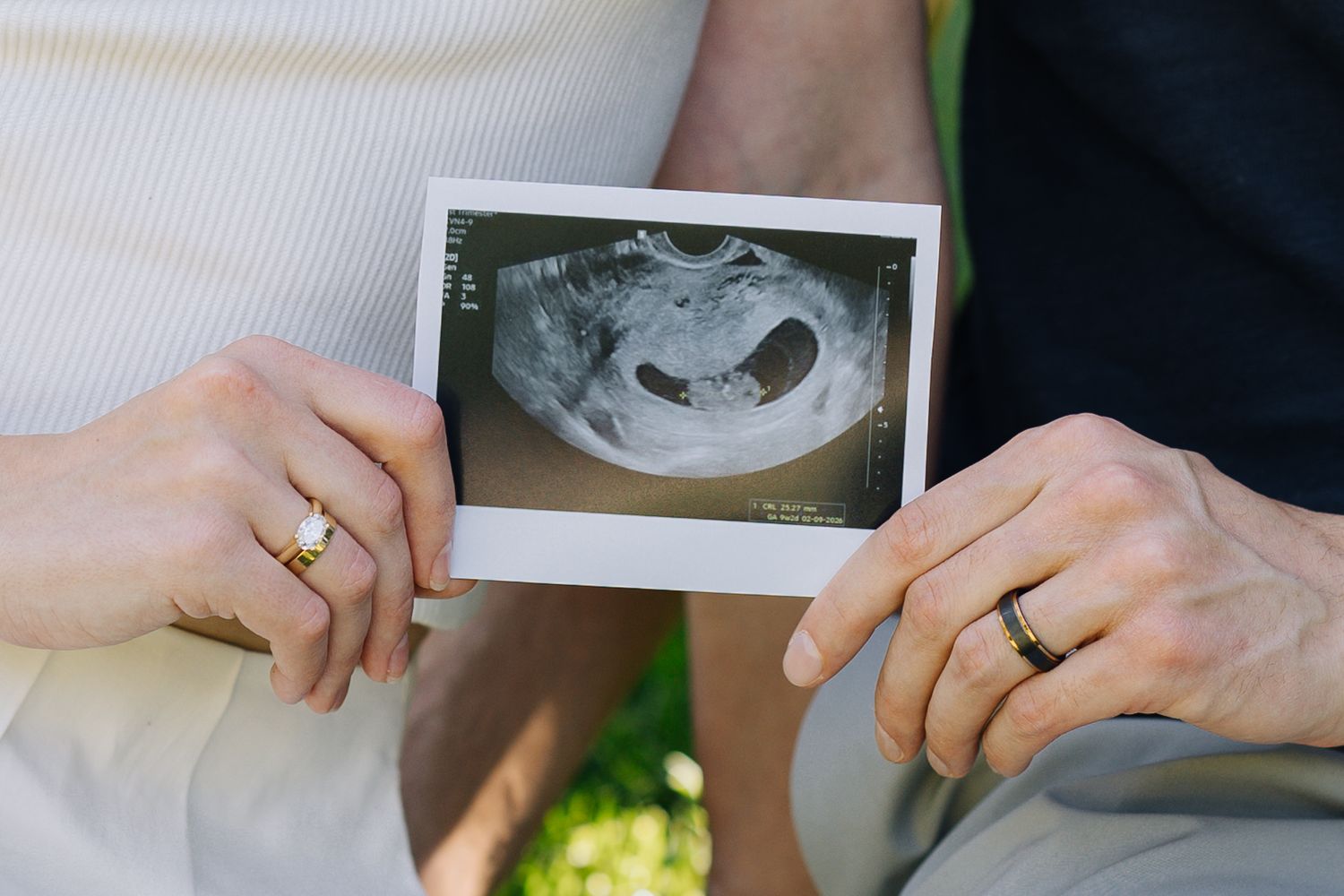 Couple holding ultrasound photo, wearing wedding rings, announcing pregnancy at Filoli Woodside photoshoot.