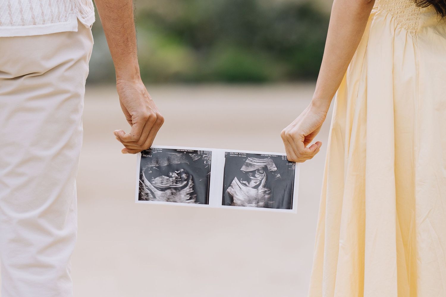 Couple holding two ultrasound photos together for a twin pregnancy announcement outdoors at Stanford Arizona garden.