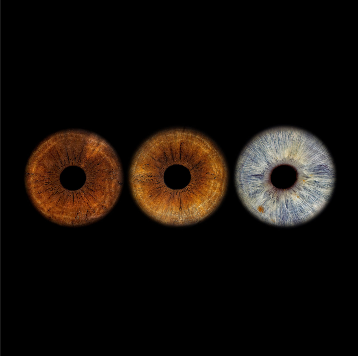 Three close-up human iris photos in amber and blue tones Multiple iris portraits combined into custom wall art in Houston Texas