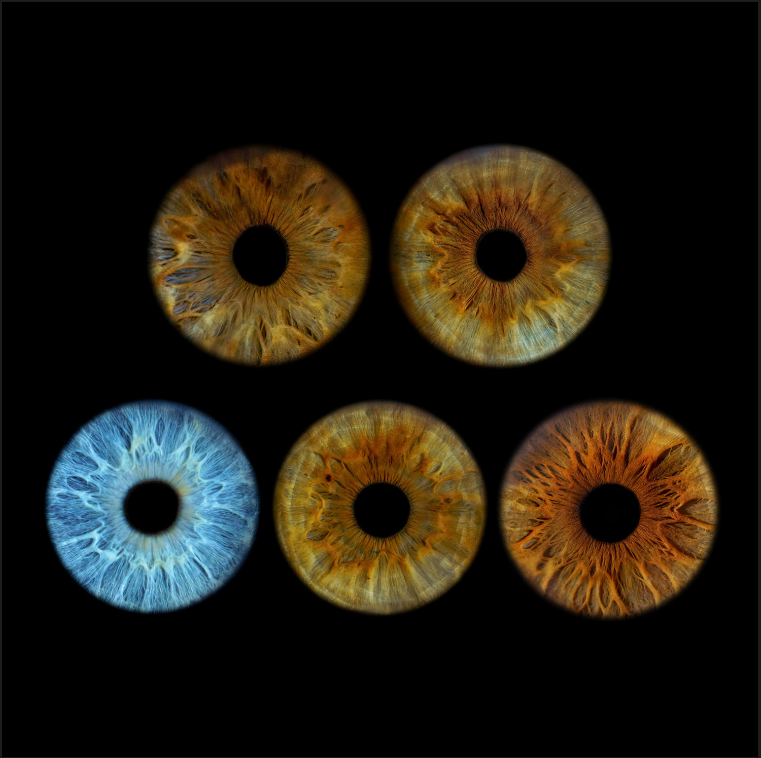 Five macro iris photographs arranged in grid showing brown and blue human eye colors on black background.
