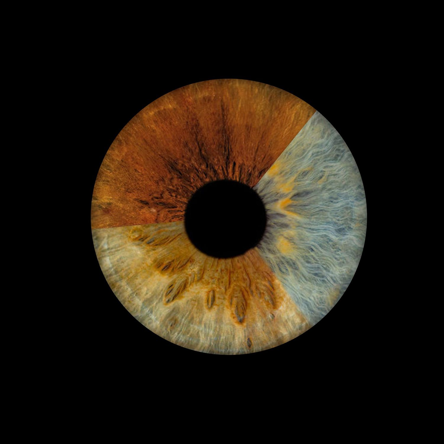 Single macro iris photograph showing half brown half blue heterochromia human eye on black background.