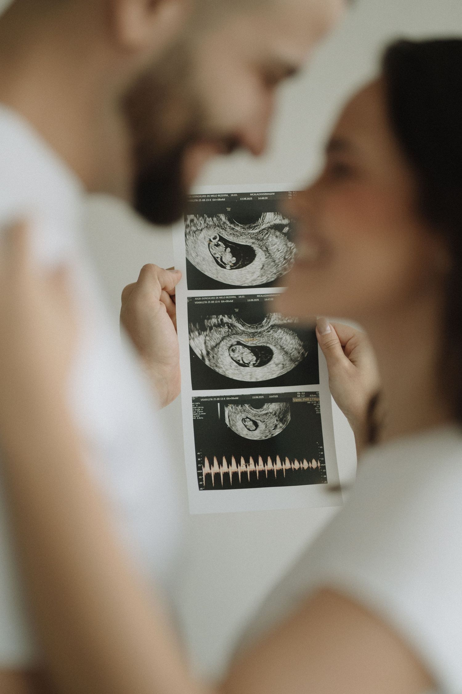 A couple holds ultrasound sonogram photos while sharing an intimate moment together.