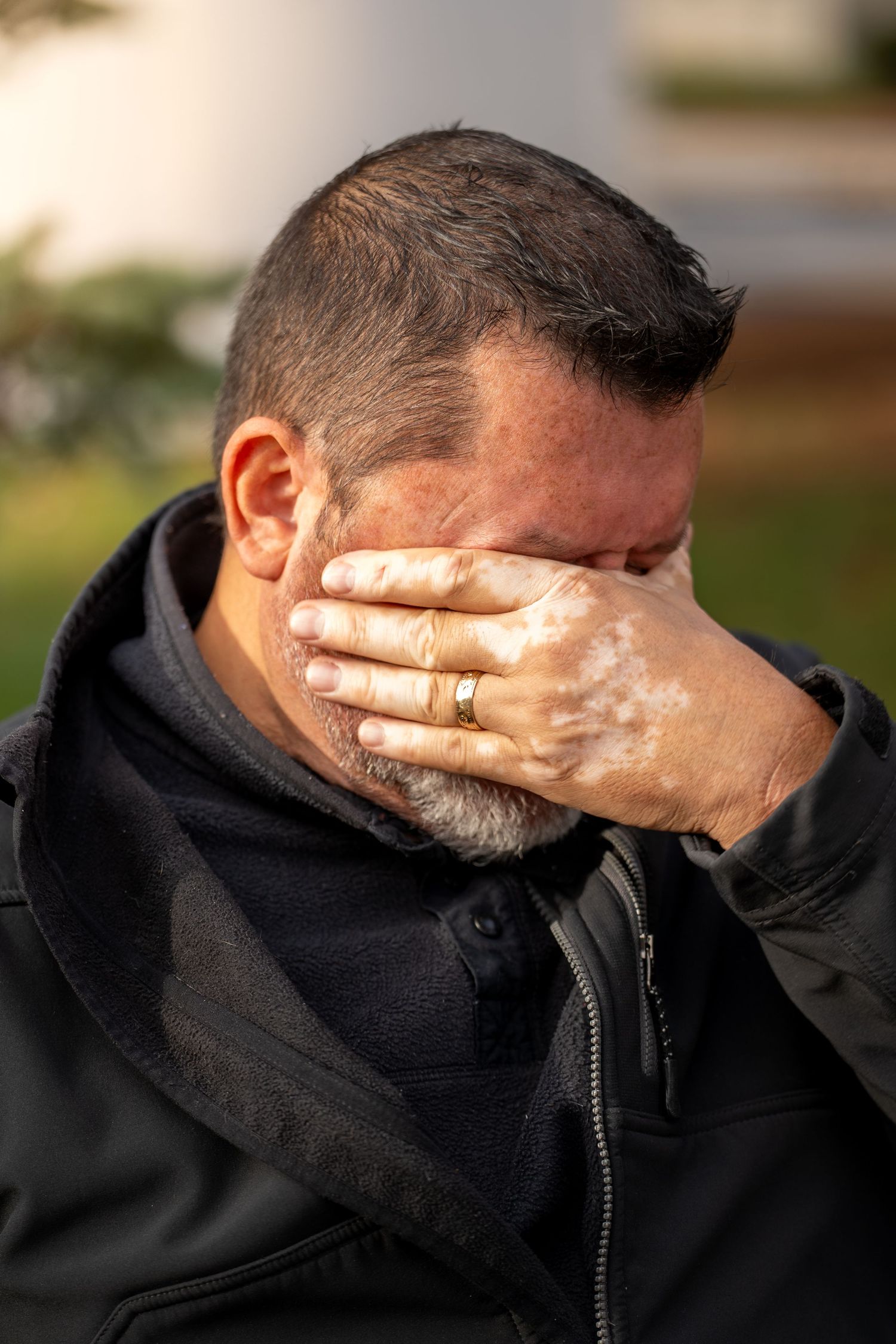 Side profile of someone in a black jacket with their face covered by their hands showing emotional distress.