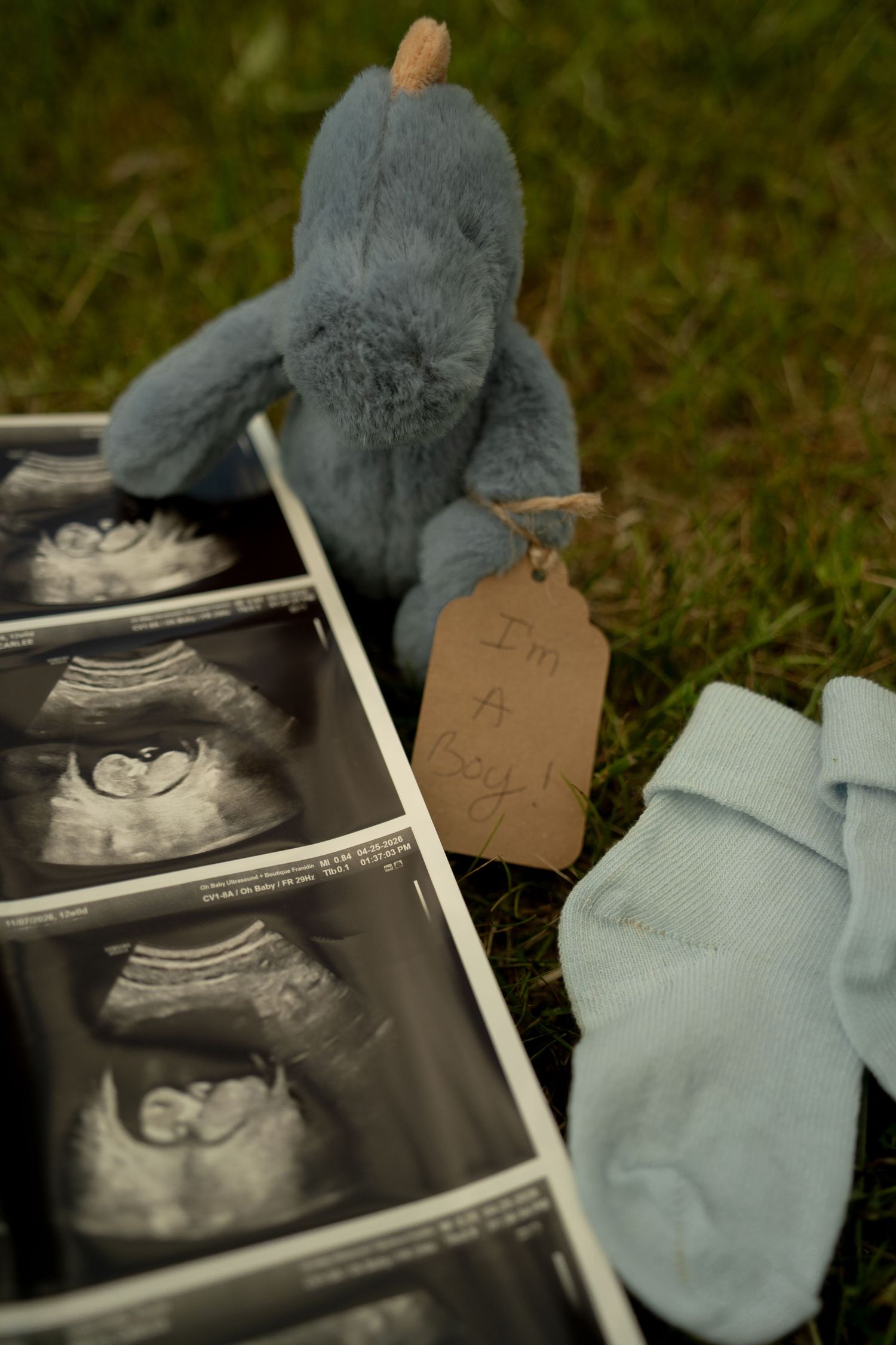 Ultrasound photos beside a blue stuffed dinosaur with an Im a boy tag and tiny blue baby socks on green grass.