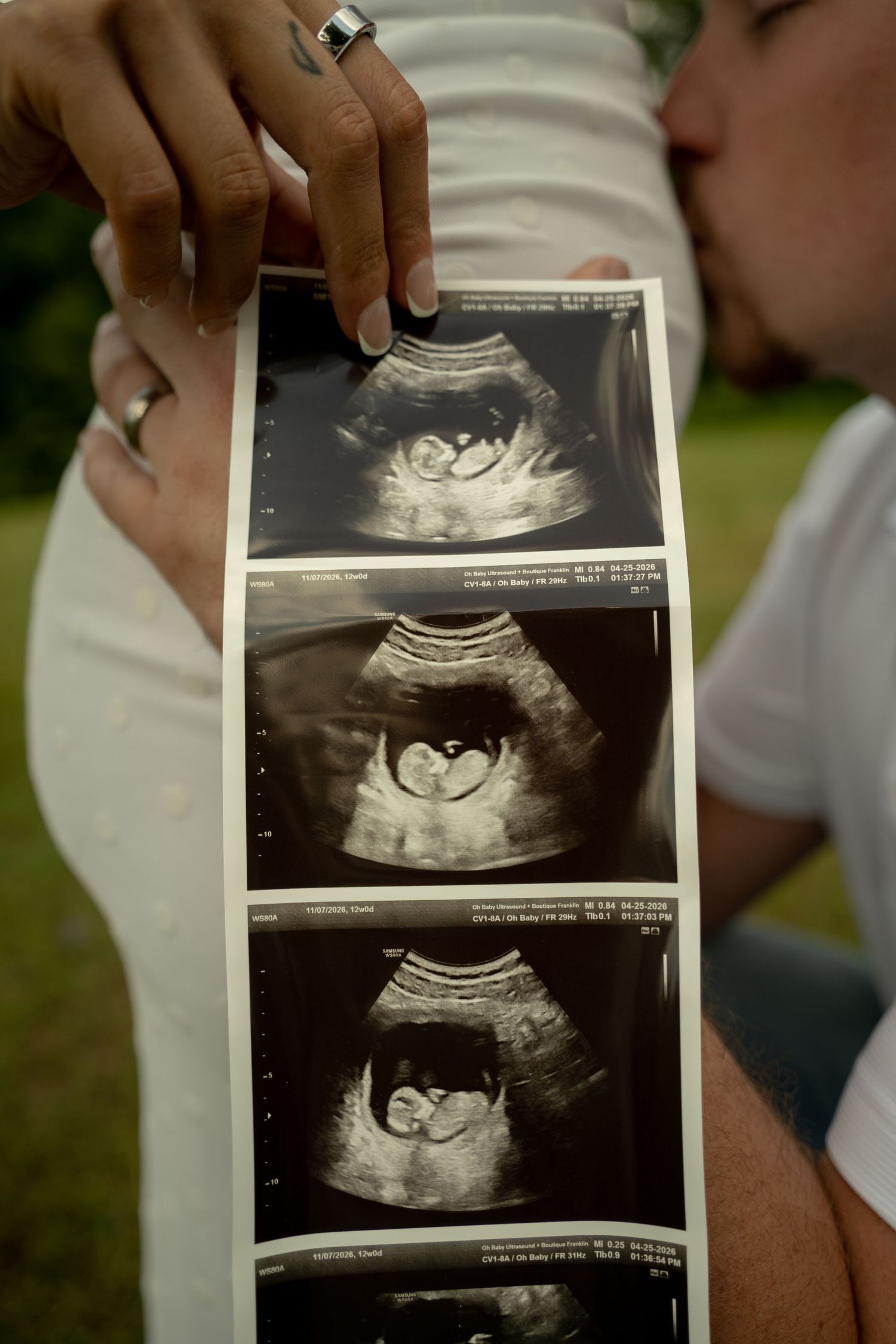 Couple holding ultrasound sonogram photos while kissing outdoors, showing three black and white fetal images.