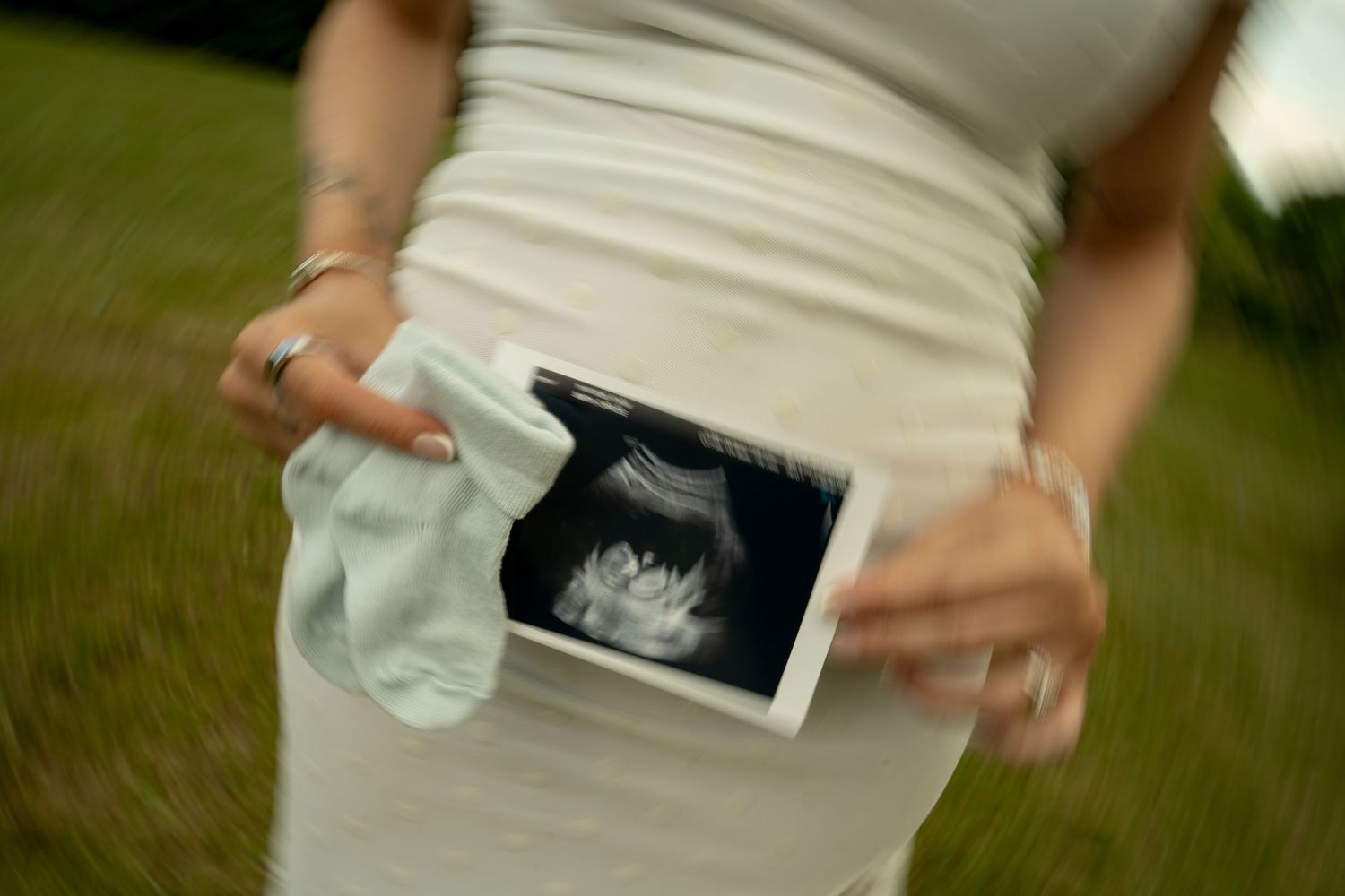 Pregnant woman in white dress holding ultrasound photo and baby sock outdoors.