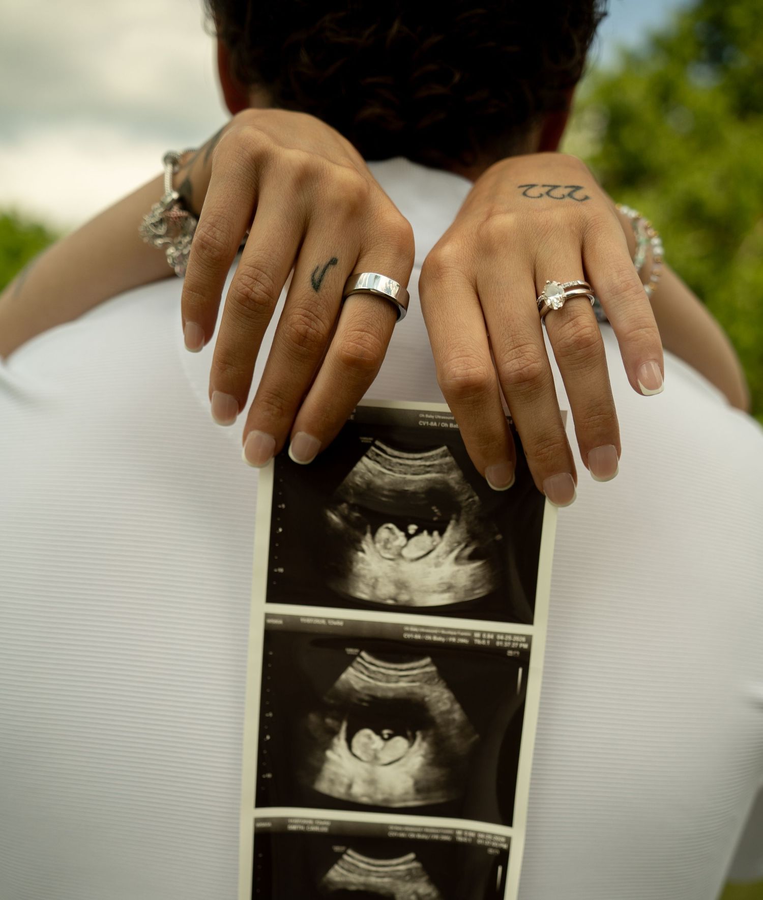 Couple holding ultrasound photos on their back, wearing wedding rings, announcing pregnancy with sonogram pictures.