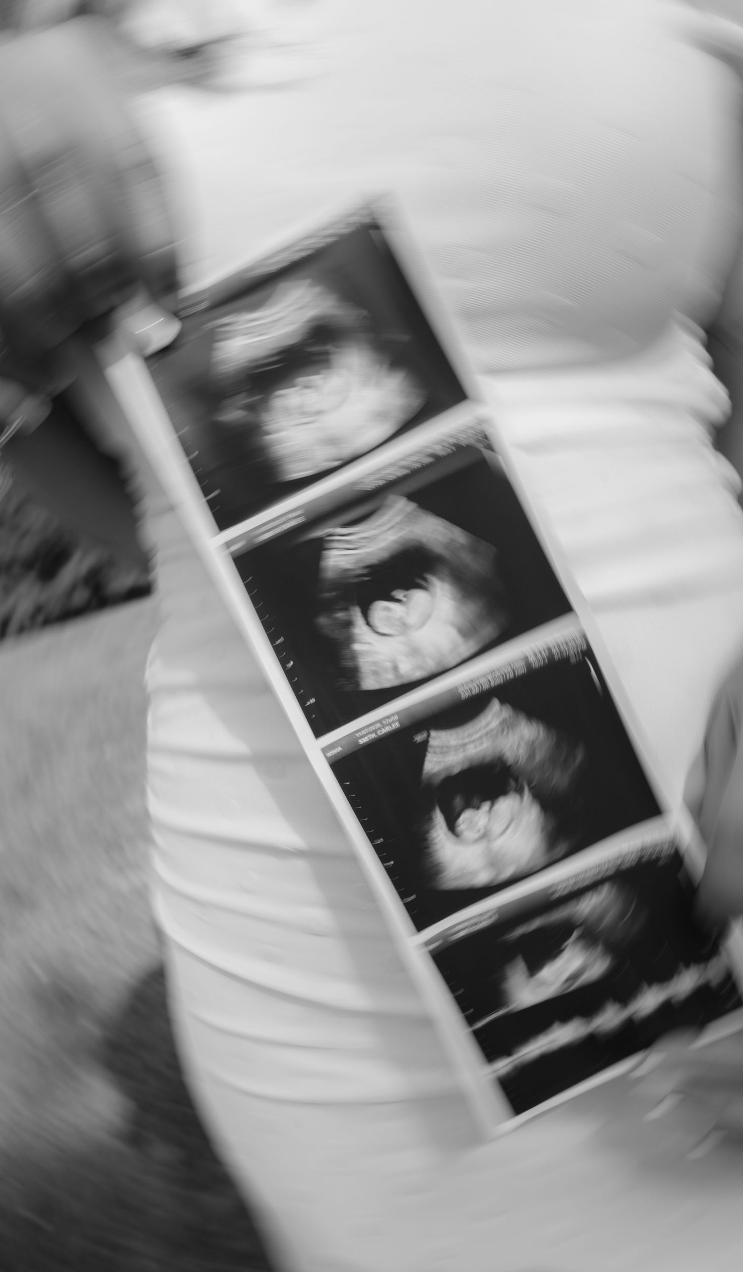 Black and white photo of pregnant woman holding ultrasound strip showing baby sonogram images against white dress.