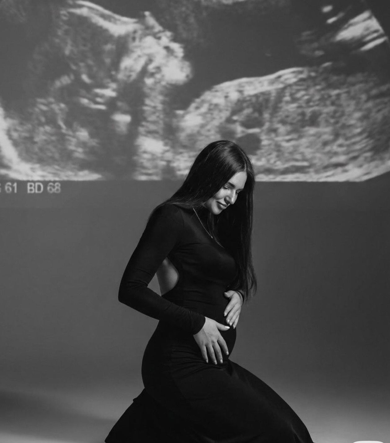 Black and white maternity photo of a woman in a black dress cradling her baby bump with an ultrasound image projected behind her.