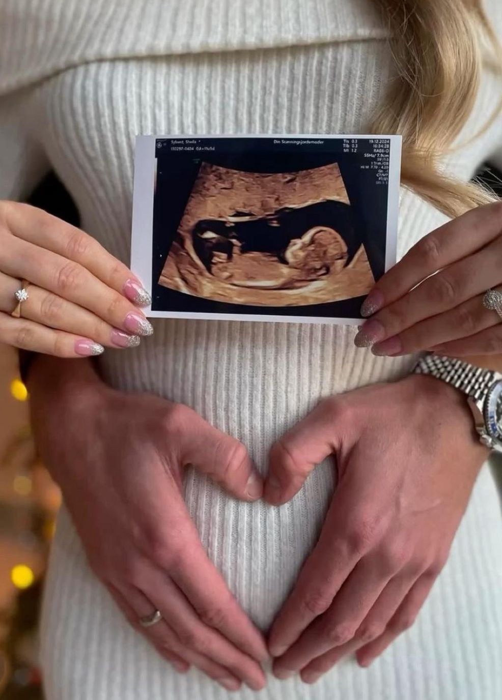 Couple forming heart shape with hands on pregnant belly while holding ultrasound scan photo, pregnancy announcement.