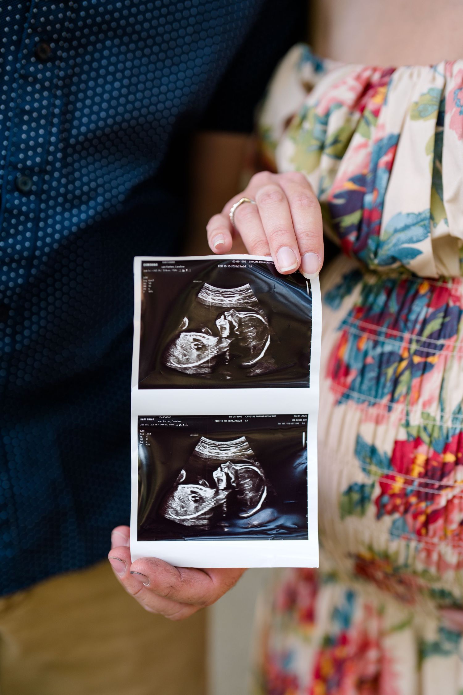 Couple holding ultrasound sonogram photos showing baby during pregnancy announcement.