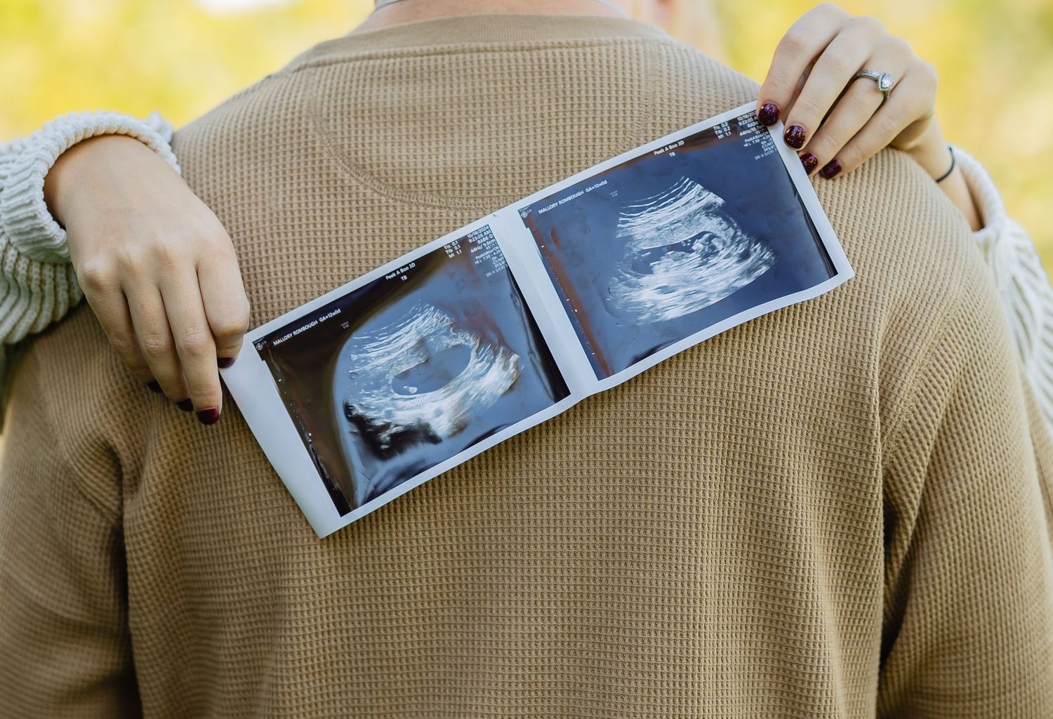 Close-up of ultrasound photos being held against tan sweater outdoors.