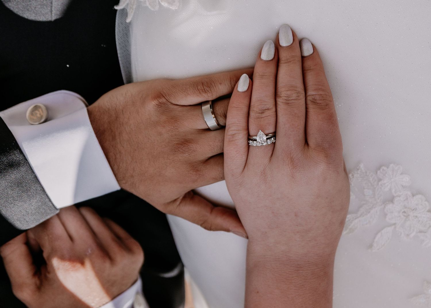 Close-up of hands showing wedding rings against white fabric.