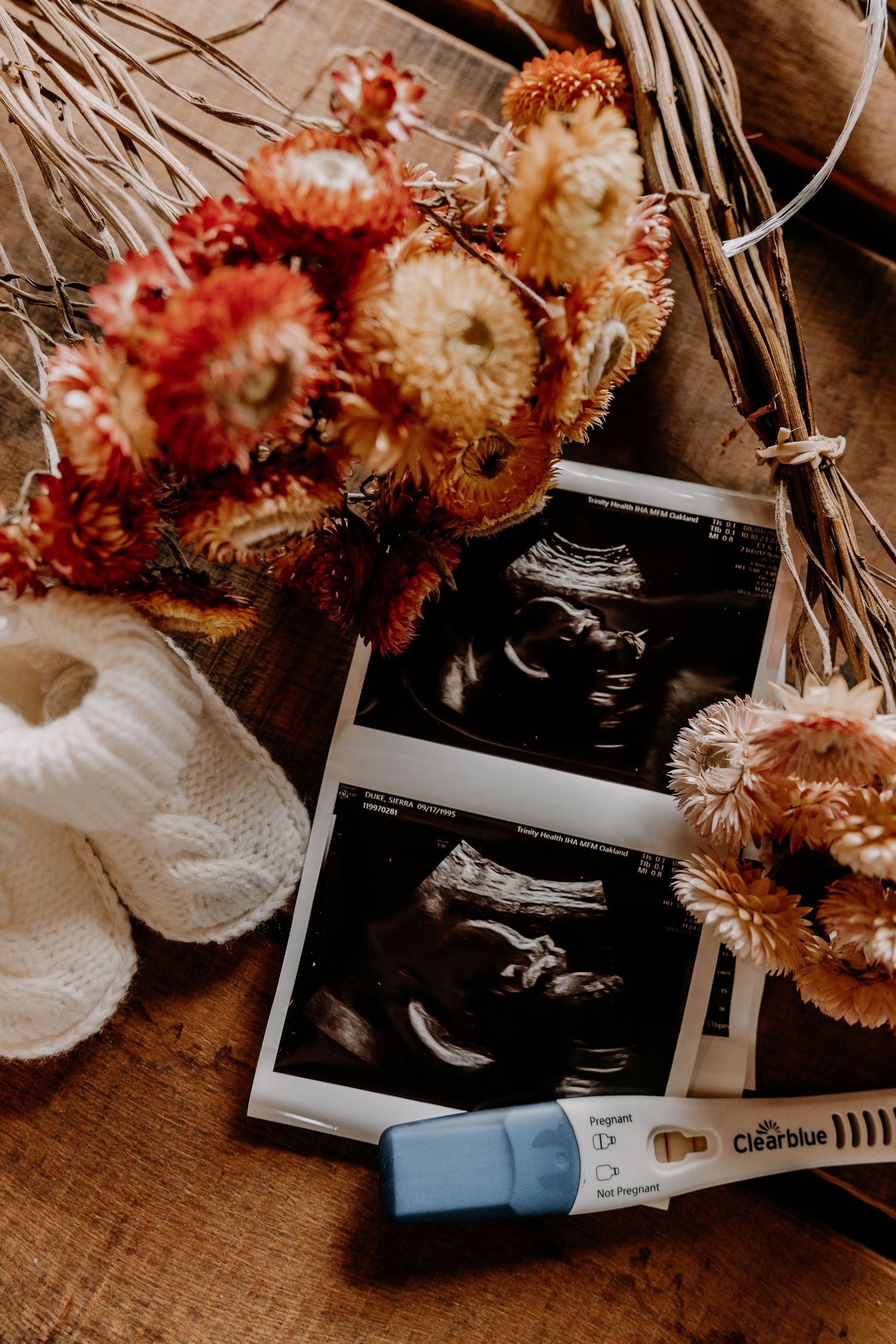 A close-up of ultrasound photos with dried flowers and a pregnancy test against a wooden background.