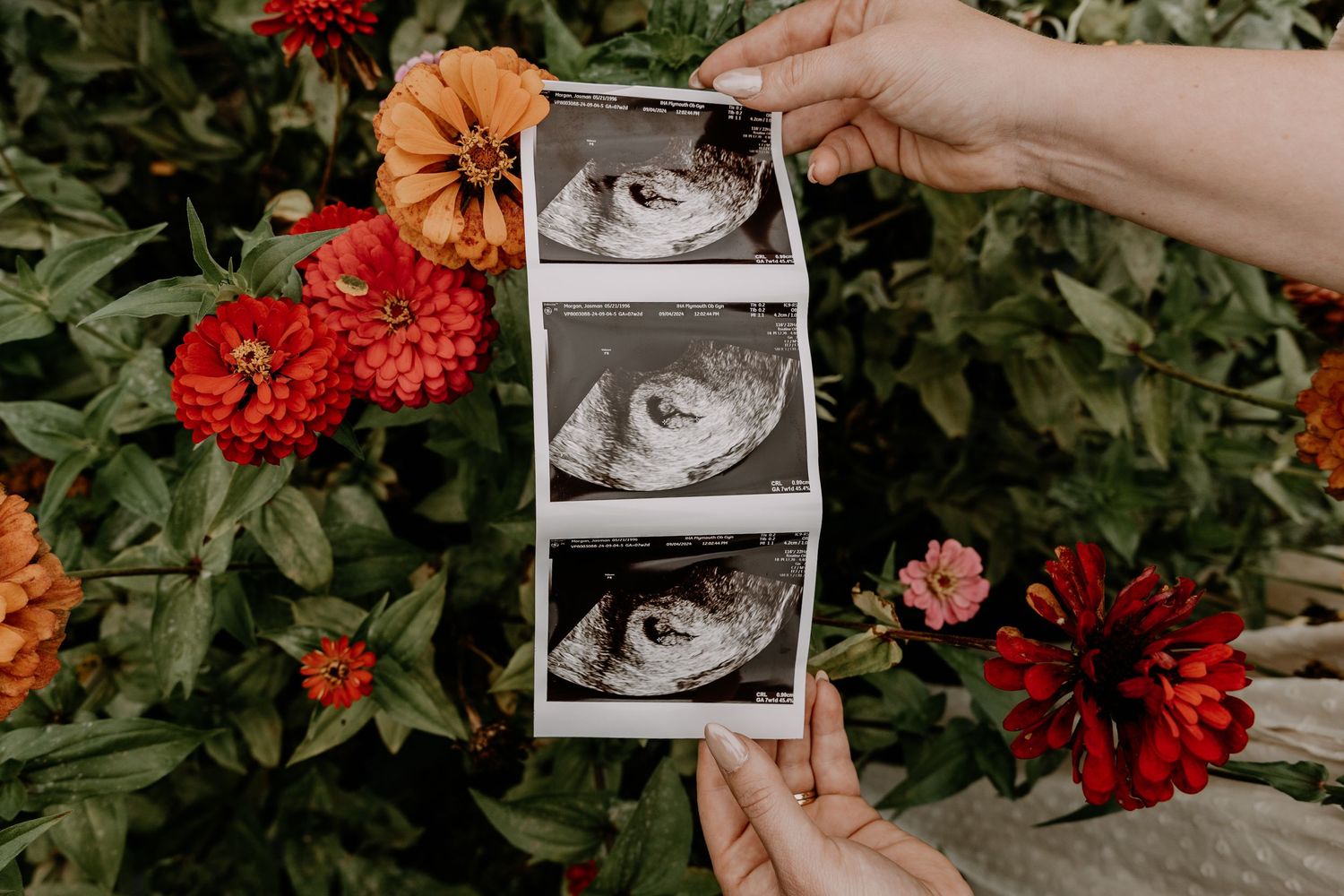 Hands holding ultrasound photos among vibrant red dahlias and greenery in garden setting.