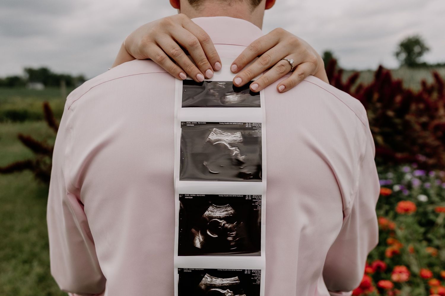 A person in pale pink clothing holds up black and white sonogram photos in each frame of a photo series.