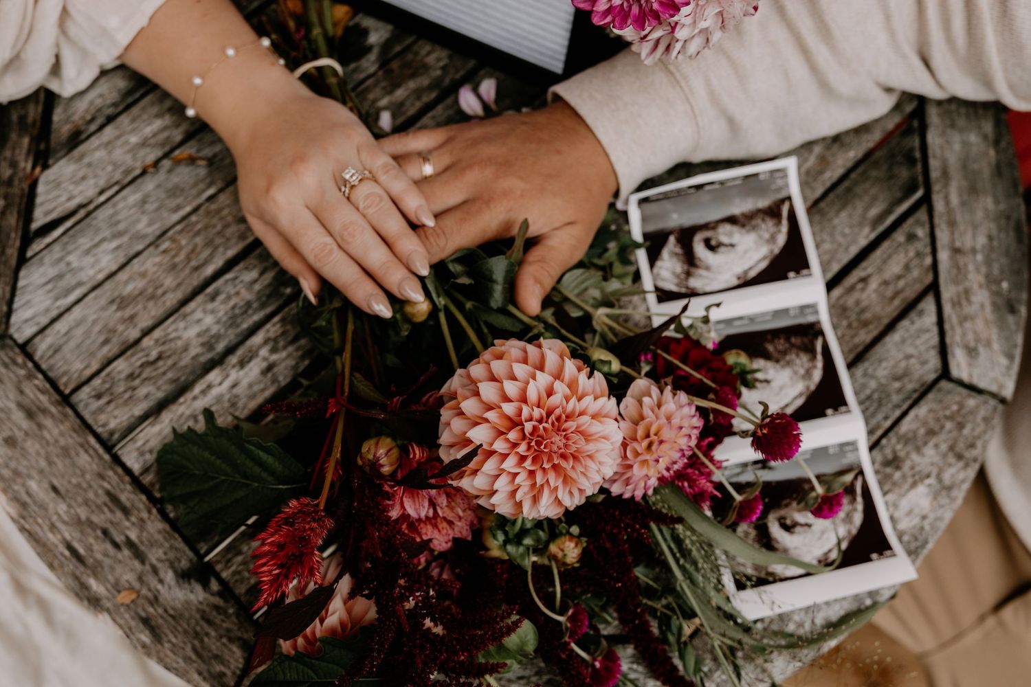 Ultrasound photos displayed among pink and cream dahlias on rustic wooden surface.
