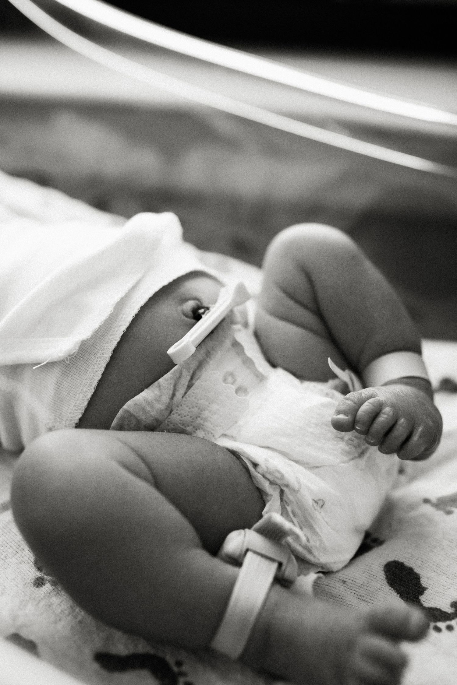 Black and white close-up photo of a sleeping infant in a medical setting showing tiny hands and medical monitoring devices.