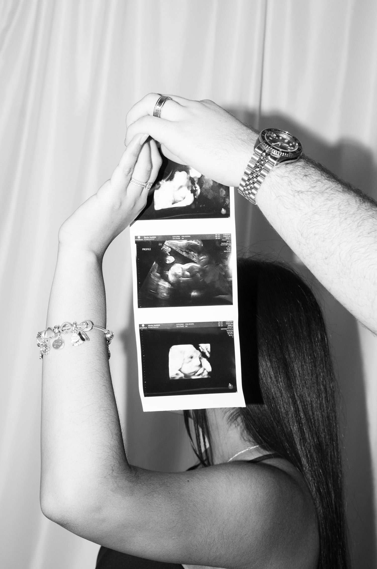 Hands holding ultrasound photos against a white curtain background.