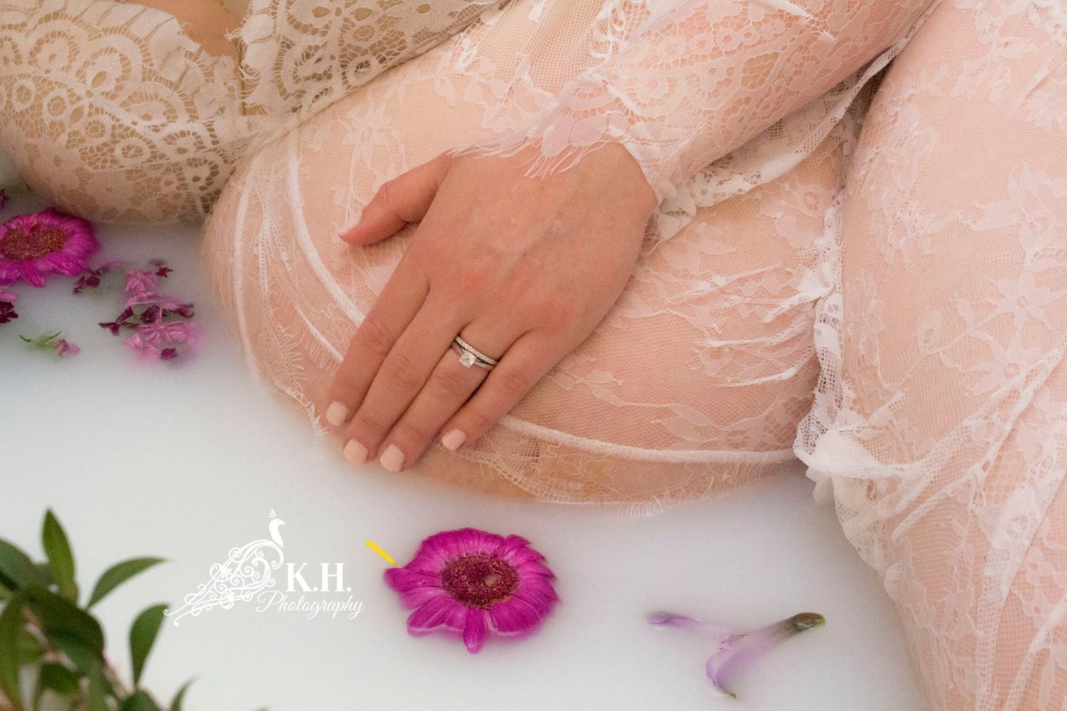 maternity