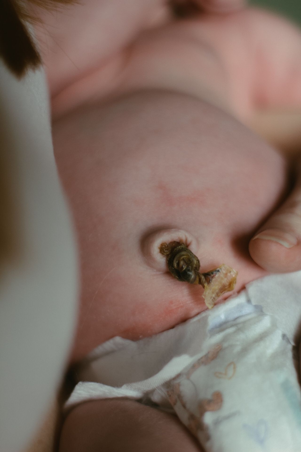 Extreme macro shot of an infant's belly button with umbilical cord stump.