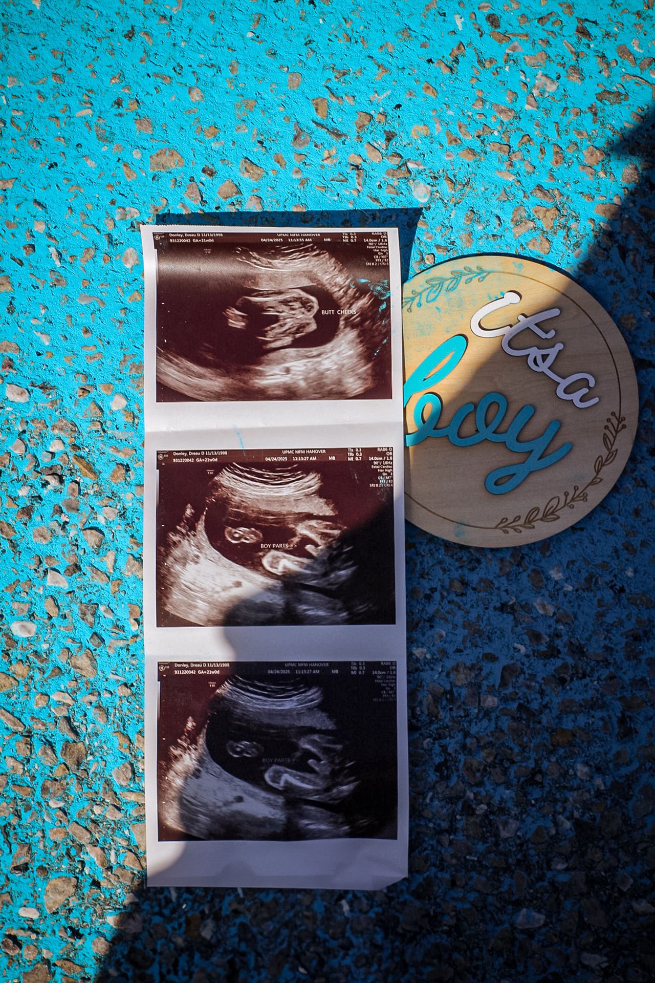 Ultrasound photos and a decorative 'It's a Boy' circle tag on a turquoise textured background.