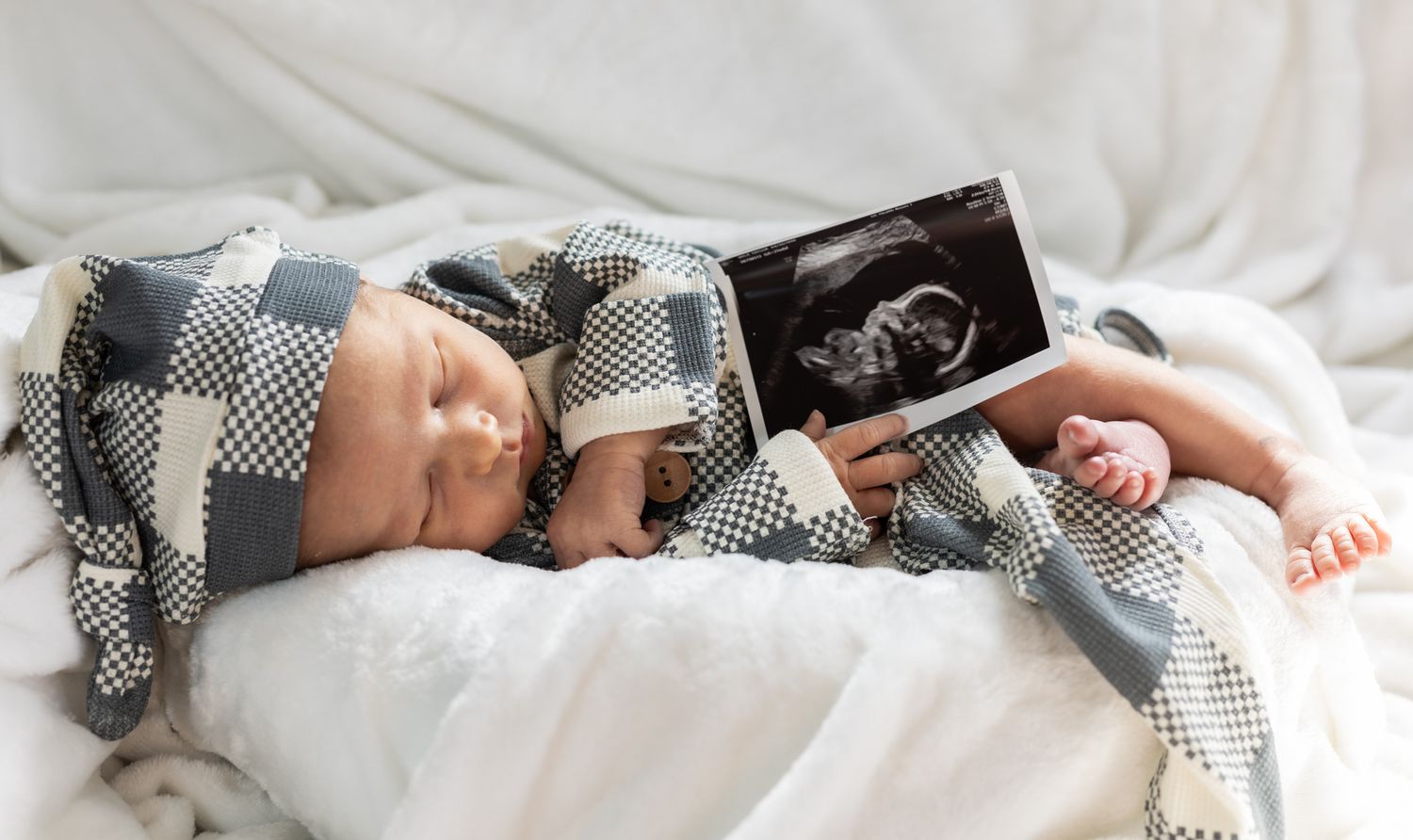 A newborn baby sleeping peacefully on white bedding with a gray and white checkered blanket holding ultrasund photo.