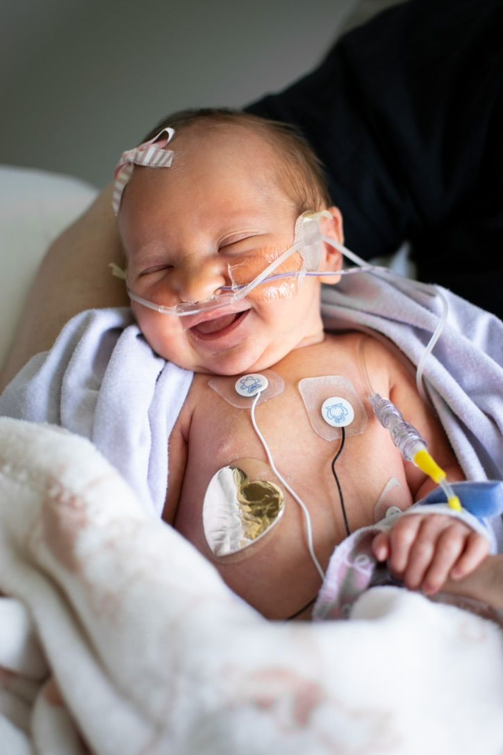 A premature baby sleeps peacefully in a hospital bed while connected to medical monitoring equipment and tubes.