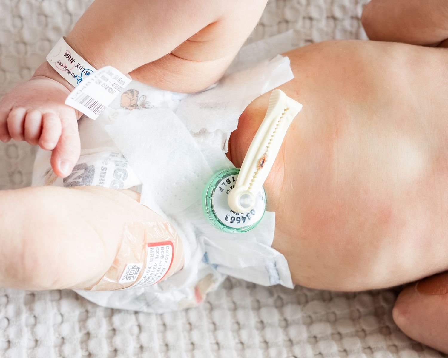 Newborn baby wearing a diaper with umbilical cord clamp, lying on a soft white textured blanket.